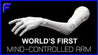 The Mind-Controlled AI Robotic Arm | Futuristic Gadgets