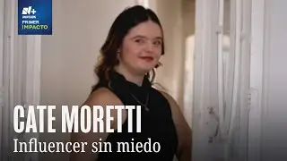 &iquest;Contratar a una persona con s&iacute;ndrome de down?