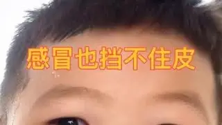 这小家伙是真感冒吗？精力旺盛的像头牛，红肿的眼睛和鼻水来作证#村里最靓的仔 #宝宝感冒 #精力旺盛的宝宝