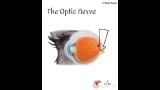 Phosphenes ???? eye flashes ?????