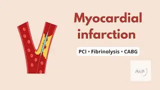 Myocardial Infarction (Part 3) | MI Treatment & STEMI/NSTEMI Management