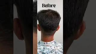 6 MONTHS of GFC Treatment 💉✨ | Shocking Hair Growth Transformation! 😱