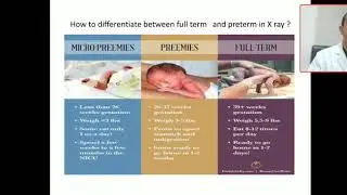 Part 4 how differentiate between full term and preterm in x ray?