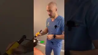 Shockwave Therapy for Frozen Shoulder, Shoulder Impingement, and Labral Degeneration