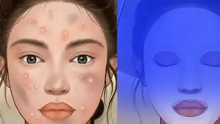 Pimple popper pro💉Makeup ASMR: Makeover story