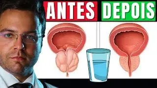 Apenas UM COPO AO DIA para DIMINUIR sua PRÓSTATA AUMENTADA | Doutor João