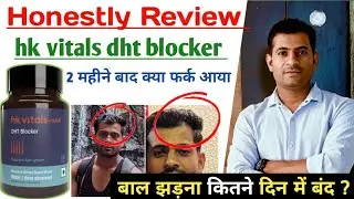 hk vitals dht blocker with biotin | dht blocker | hair fall solution | best hair dht blocker 