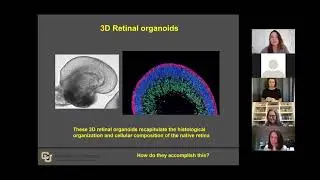 Using Stem Cell-Derived Retinal Organoids for Therapeutic Development