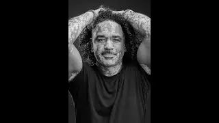 Living with Vitiligo TEDx | Omar Sharife |  March 2025 - Vancouver