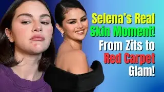 Selena Gomez Shows Off Zits in Candid Selfie | Bold Red Carpet Looks from 'Emilia P&eacute;rez' Premiere