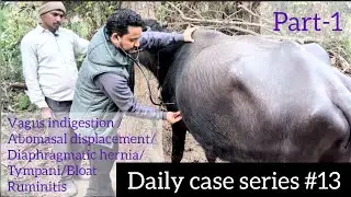 Daily case series #13 Part-1#Dr. Vijay Verma 