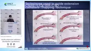 2021 COACT CHIP WORKSHOP 2 (AUDITORIUM) : Guide extension catheters (Guidezilla / guideliner) 김찬준