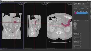Annotation of the pancreas using the Chimaera Annotation Tool