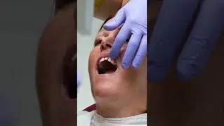 Celebrating Confident Smiles at Smile Dental Turkey