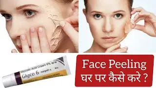 Glyco 6 Cream | Chemical Peeling | Face Peeling | Glycolic Acid Cream | की पुरी जानकारी