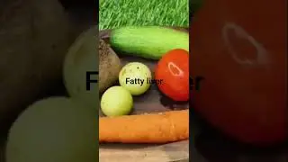 Fatty Liver + Belly Fat Remedy 🌿 | Liver Detox & Waist Slim  #Healthy Lifestyle #reducebellyfat