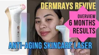 6 Month results, Multiple Concerns Laser, DermRays Revive, Less Office Visits #beautydevice