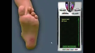 Emergency Room: Disaster Strikes - Case 234 - Foot impaled, streaking (Juan Resendez, Lymphangitis)