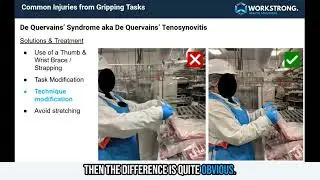 Case Study   De Quervain's in meat processing