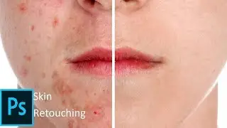Photoshop Tutorial: How to Quickly Smooth Skin and Remove Blemishes & Scars