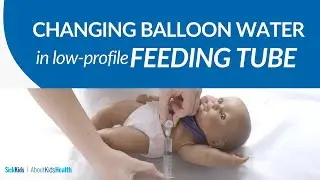 How to change the water in the balloon of a low-profile feeding tube | AboutKidsHealth at SickKids