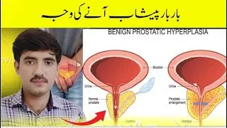 1 CUP DRINK AND REDUCE PROSTATE | Medical Treatment | Home Remedies | Desi Totky.