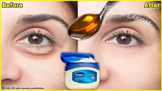 In 3 days Remove Under Eye Bags Completely | Remove Dark Circles, Wrinkles, and Puffy Eyes
