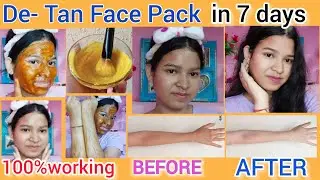 How to remove Sun Tan at home | Diy home remedies 🌞