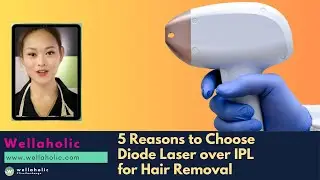 Diode Laser vs  IPL Why Choose Diode for Hair Removal   #Wellaholic