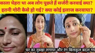सिर्फ 7 दिन में चेहरा चमकेगा ! घर पर बनाएं ये Powerful Ayurvedic Face Serum- झाइयां,दाग-धब्बे, गायब
