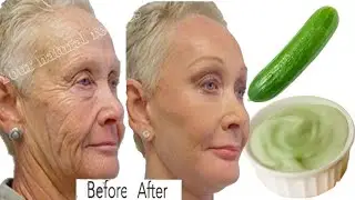 Magical cream 💥for firming the skin and removing wrinkles around the eyes, mouth and forehead