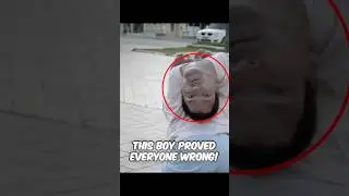 THIS BOY PROVED EVERYONE WRONG! This guy has an upside-down head #shorts