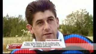 ACA Lyme Story