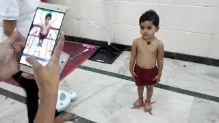Child Growth Monitor: A Game-changing App to Detect Malnutrition