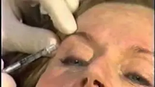 Botox for a Youthful Appearance: Cosmetic Plastic Surgery in Toronto