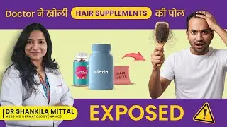 Are You Wasting Money on Hair Supplements? | Best Hair Vitamins & Capsules to Reduce Hair Fall