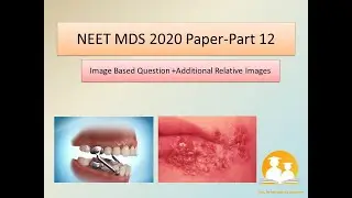 NEET MDS 2020 Paper Discussion |Part 12| Image based Questions |Sail To MDS Dental Academy