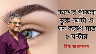 চোখের পাতলা ভুরু মোটা ও ঘন করুণ মাত্র ১ ঘণ্টায় | চোখের পাতা এবং ভুরু ঘন করার এক অভিনব উপায়