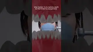 Dedicated Dentist 👆😅 #dentist #dentistry #dentalcare #dentalclinic #patient #doctor