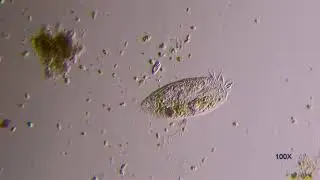 Stylonychia Ciliate  under microscope