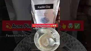 Acne diy face mask👆kaolin clay #pimpleproblem#short#koreanskincare#glassskin#shorts#youtubeshorts