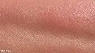 Skin Organ Frequency 296.7 Hz