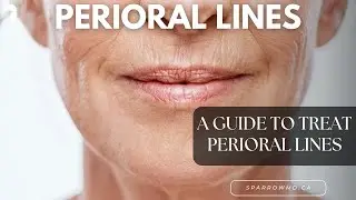 Treating Perioral Lines