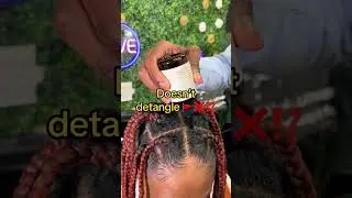 Restore Your Edges and Hairline | Scalp Health | Hair Care Red Flags