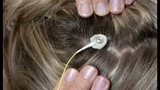 How to Set Up NeurOptimal + Start a Session