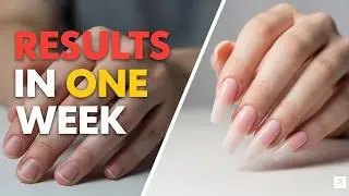 How to get LONG, WHITE, STRONG nails ✨🎀 &ndash; Grow Them FAST This Week!
