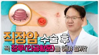 장루에 대한 궁금증? 모두 해결해드립니다! ｜(장루의 모든 것 A to Z)