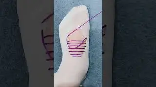 Don't Throw It Away! How to Fix a Large Hole in Socks (Satisfying DIY Repair)