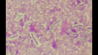 BACTERIAL CAPSULES & SLIME LAYERS