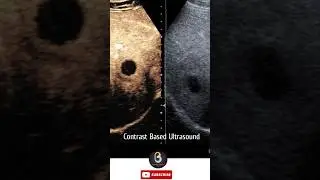 Contrast Based Ultrasound Machine | Biomedical Engineers TV #ultrasoundscans #science #hospital